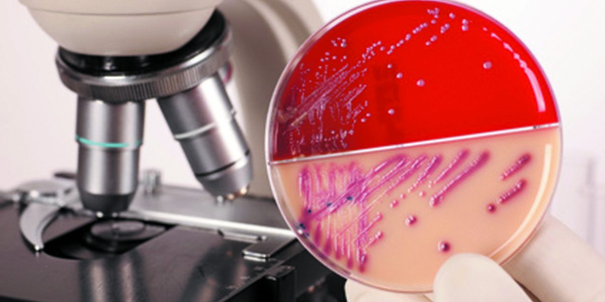 initiation à microbiologie alimentaire